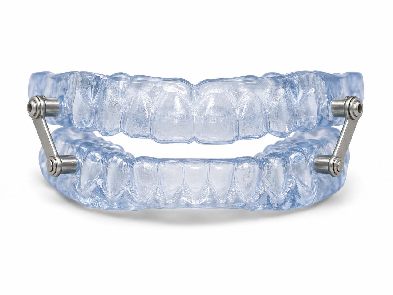 Exemplo de dispositivo de avanço mandibular